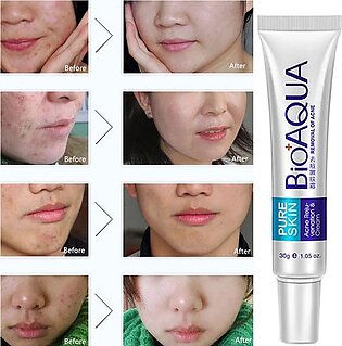 Bioaqua Pure Skin Acne Removal Anti-wrinkle Treatment Cream Bqy0719