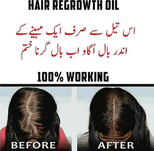 Hair Anti Fall King Oil For Men & Women 30ML