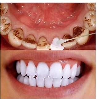10ml Teeth Whitening Water Oral Hygiene